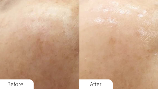 Aquapure Before and After