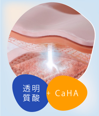 HArmonyCa 美神針