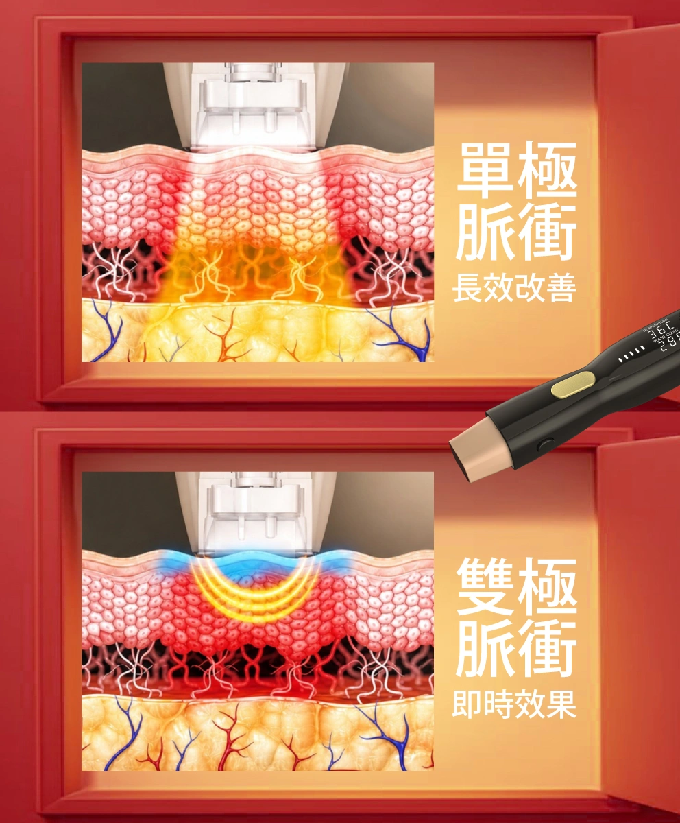 density 無雙電波