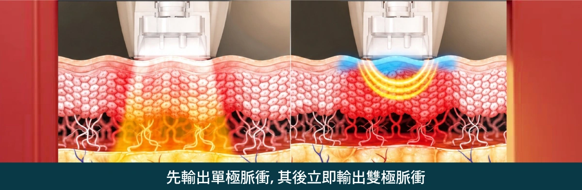 density 無雙電波