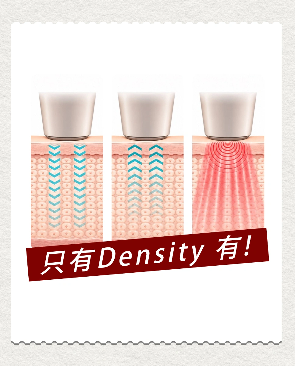 density 無雙電波